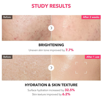 APRILSKIN TXA Niacinamide 99 Milky Toner 150ml