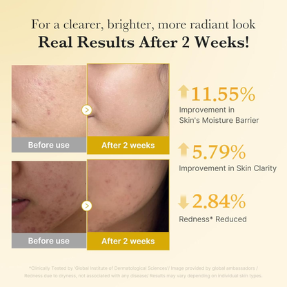 MEDICUBE Kojic Acid Turmeric Niacinamide Serum 30ml