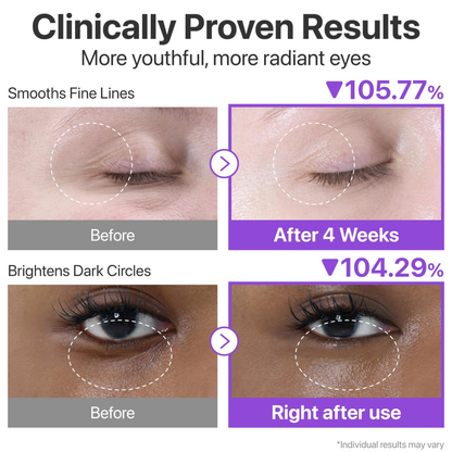 NUMBUZIN No.9 NAD+ Retinol Volumetox Eye Cream 10ml