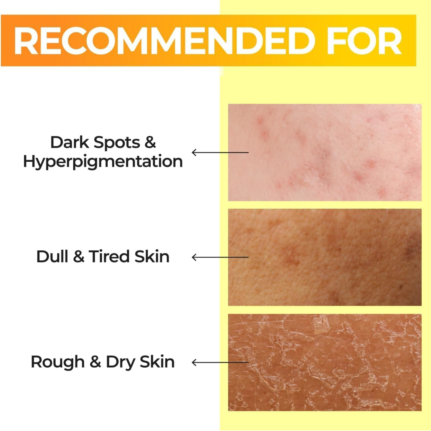 NUMBUZIN No.5 Vitamin Boosting Essential Toner 200ml