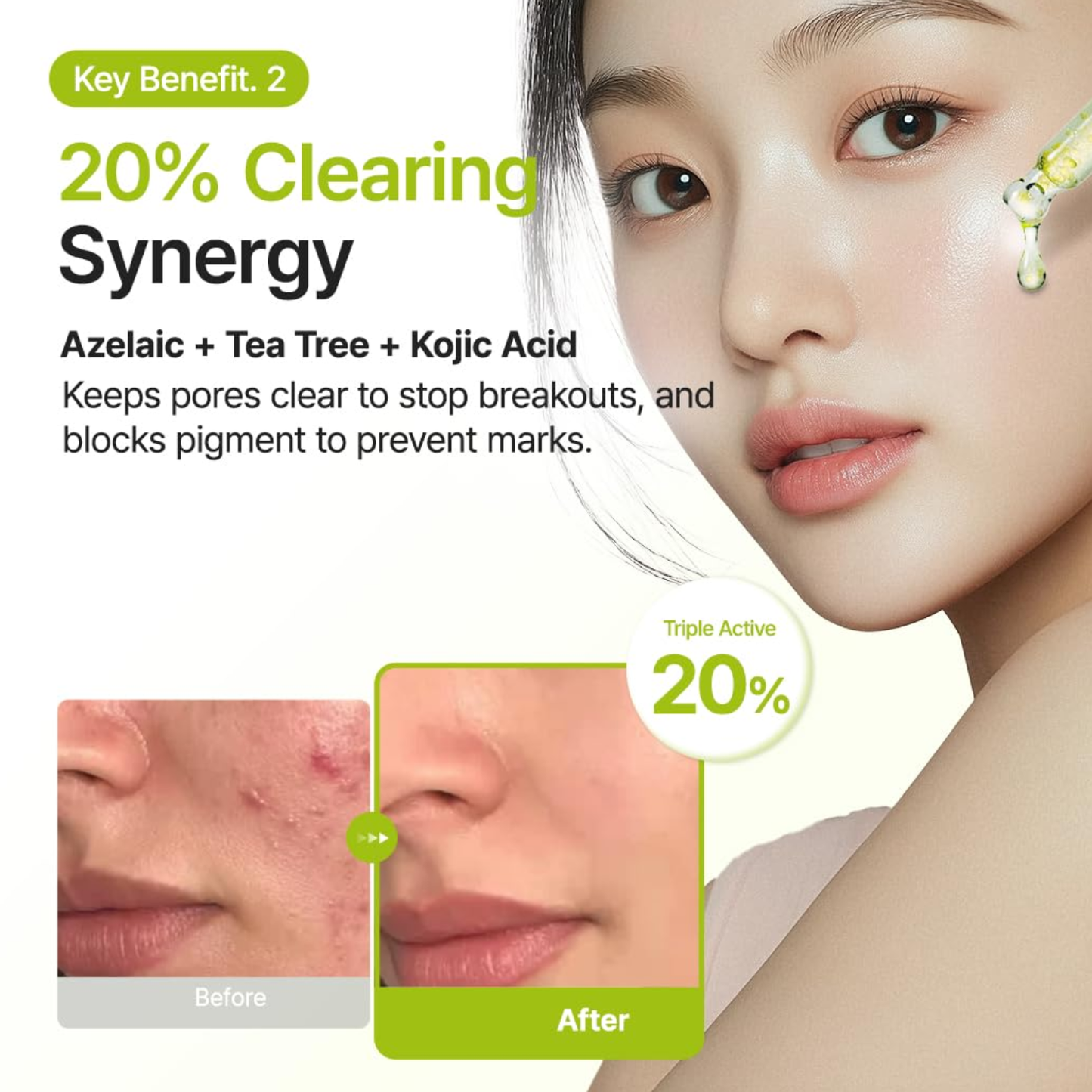 PURITO SEOUL Azelaic Acid 10 Kojic Tea Tree Serum 30ml